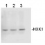 HXK1 | Hexokinase 1 (Chlamydomonas)